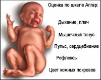 оценка ребенка по шкале Апгар